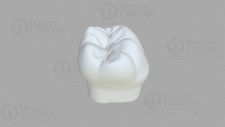 300019 Mandibular 1st Molar 3D Model