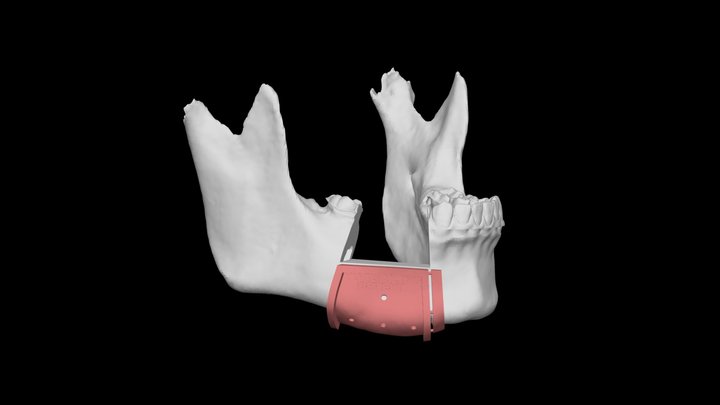 陳醫師專區 3D Model