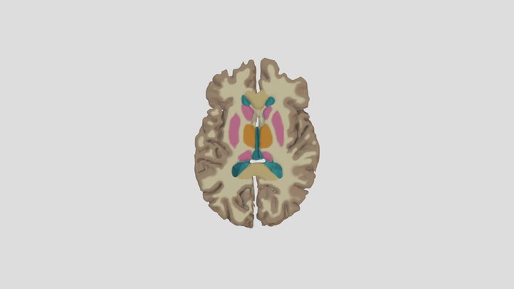 Axial Brain at the Basal Nuclei 3D Model
