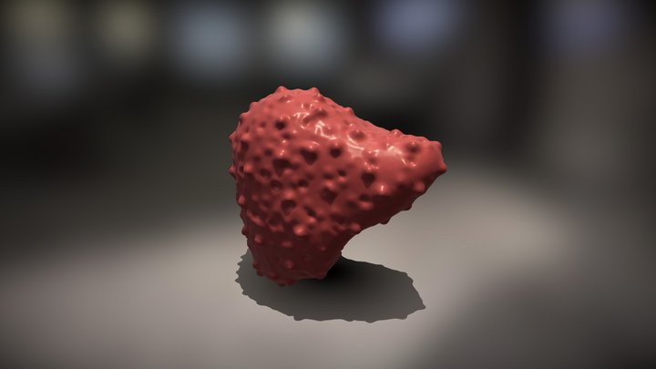 Liver Segmentation - Light Cerrhosis 3D Model