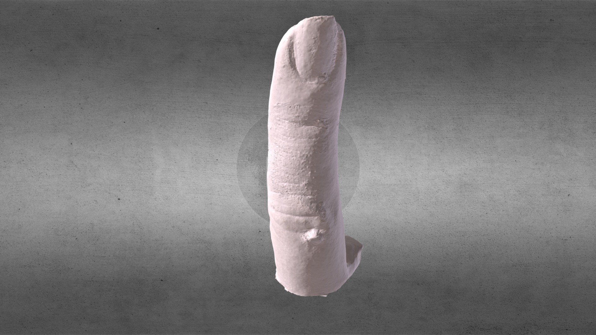 Finger Cast