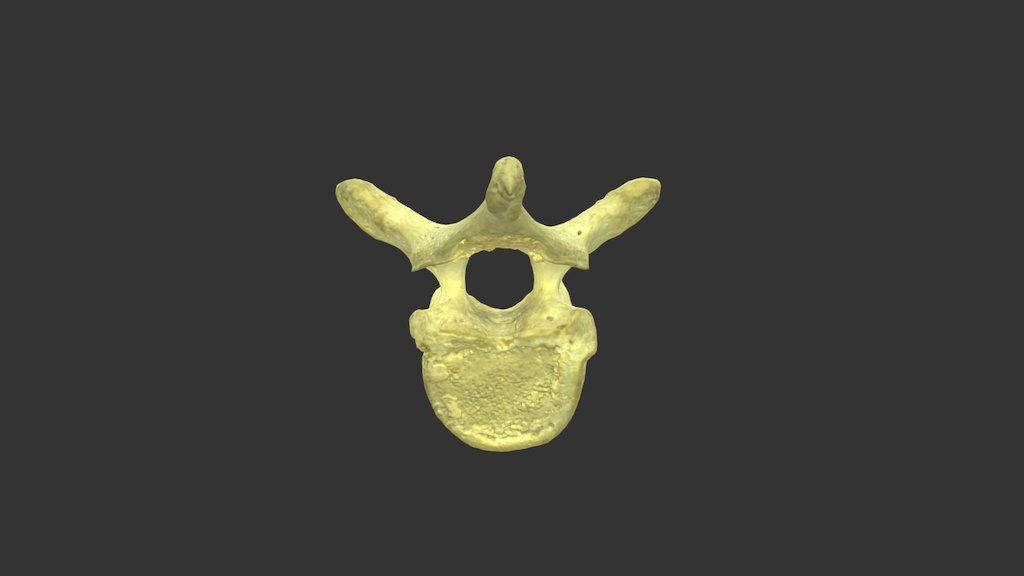Thoracic Vertebra with Texture - 3D model by Wellesley College ...