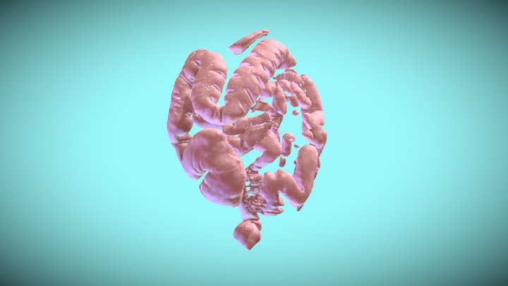 Megacolon 3D Model