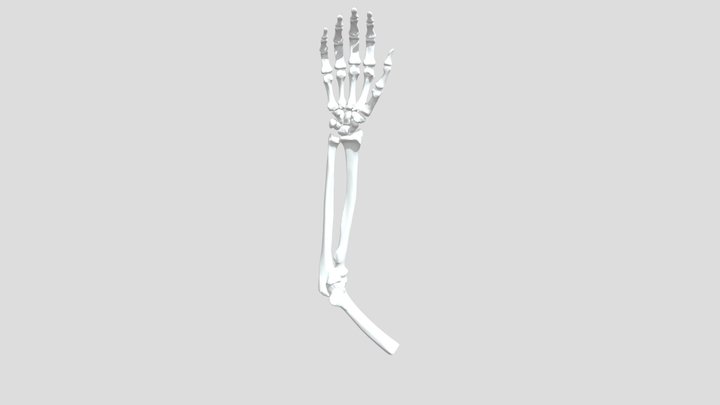 Arm CT 3D Model