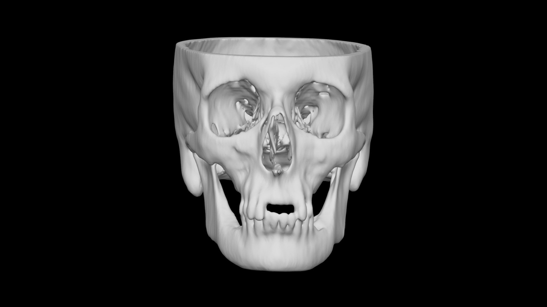 Skull Male 60yo