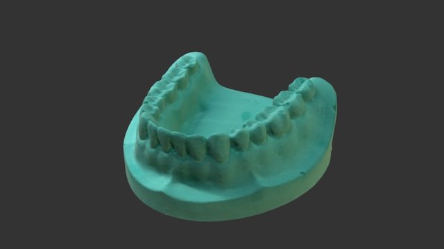 MNR_Dental_scan 3D Model