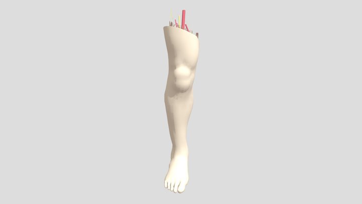 diabetic foot 3D Model