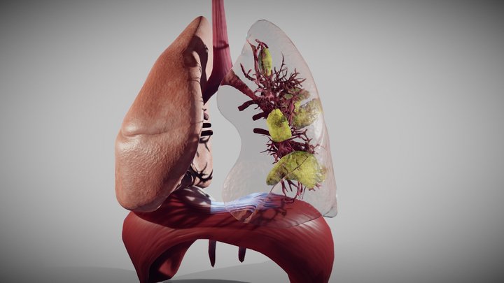Covid-19 patient's lungs version1 (animated) 3D Model