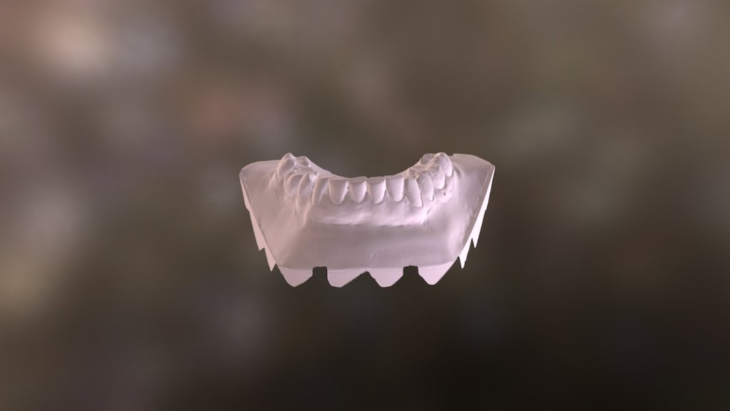 Amanda Lower Jaw