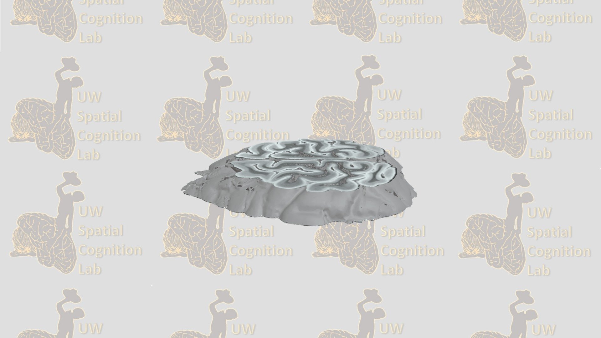 Axial Slice 2
