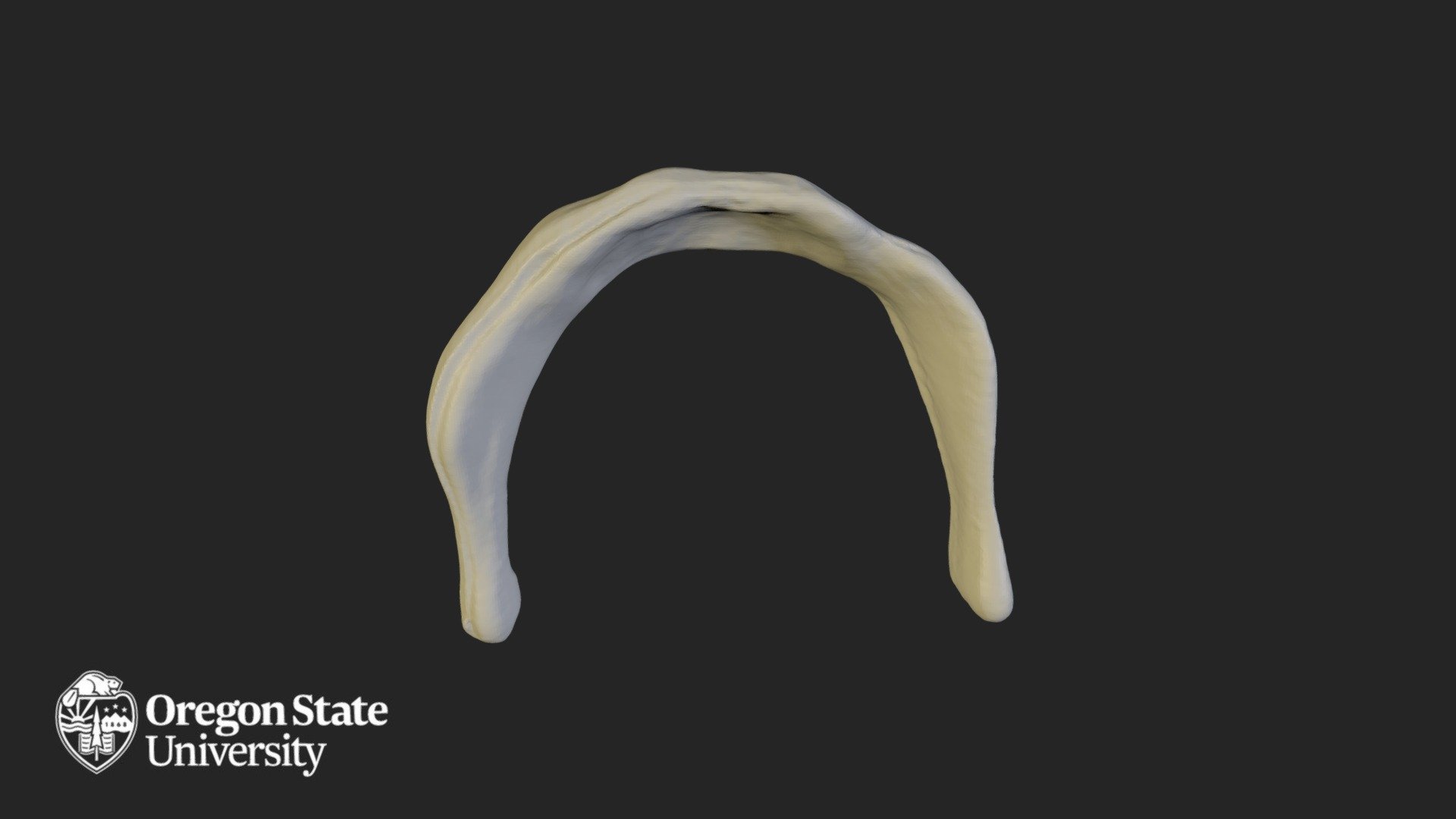 Hyoid