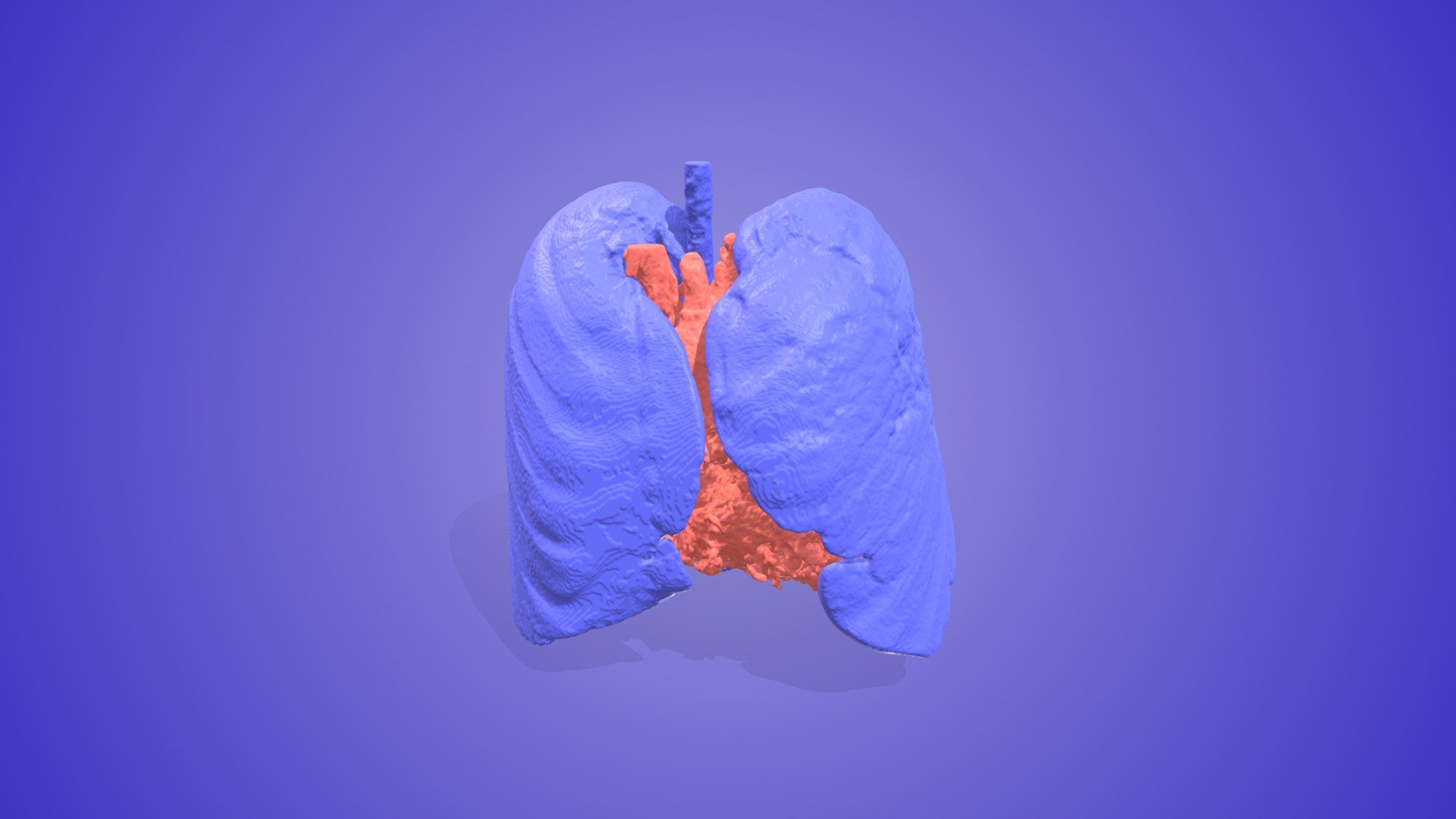 Aortic Aneurysm with Lungs - 3D model by 3D Heart Project ...