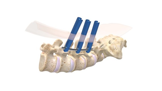 MISQ 2016 XCC 3D Model