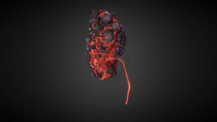 Kidney Exp 03 3D Model