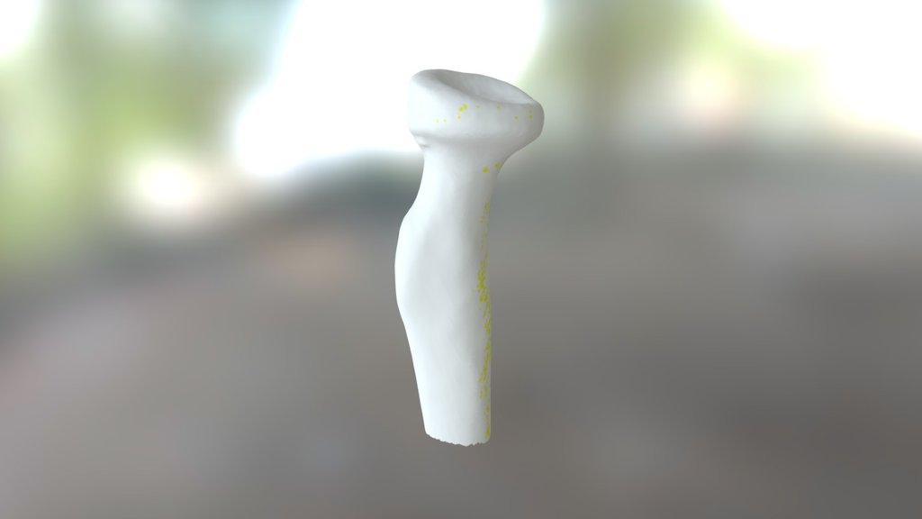 Proximal Radius Warm — Sketchfab embed 3D viewer