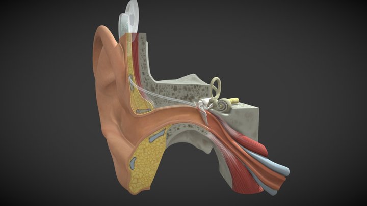 How a Cochlear Implant Works 3D Model