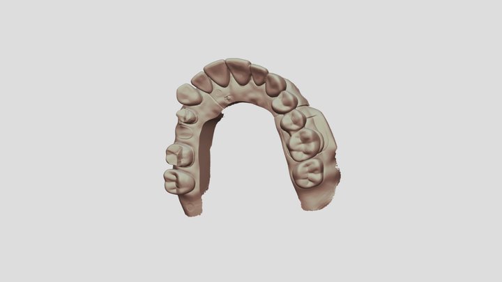 6 Upper Jaw Scan 3D Model