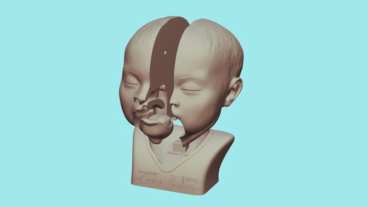 Cleft lip educational model C Lipspleet 3D Model
