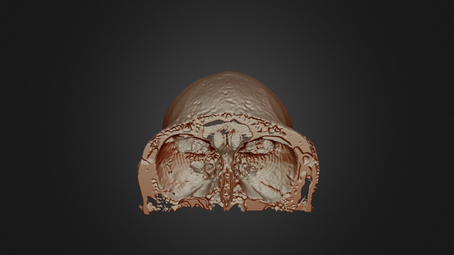 MRI Skull Decimated