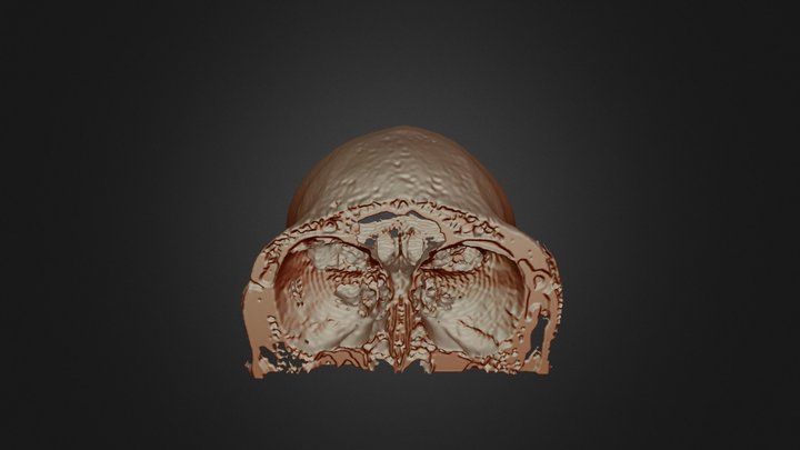 MRI Skull Decimated 3D Model