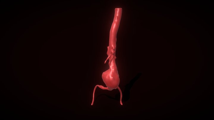 Aorta Segementation 3D Model