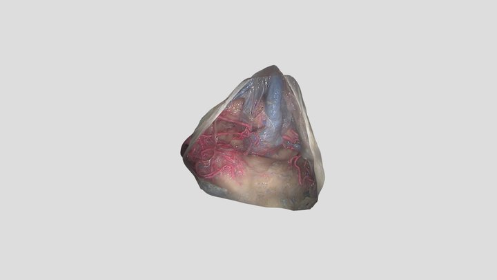 SCIT: pineal region 3D Model