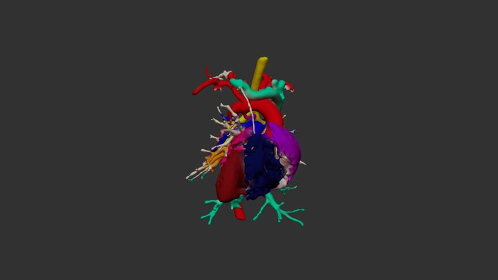 Heterotaxy – Free 3D Model STL