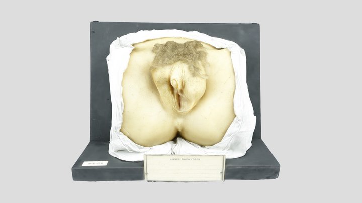 Cire anatomique - Hermaphrodisme 3D Model