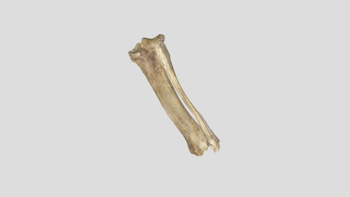 Tibia-bone 3D models - Sketchfab