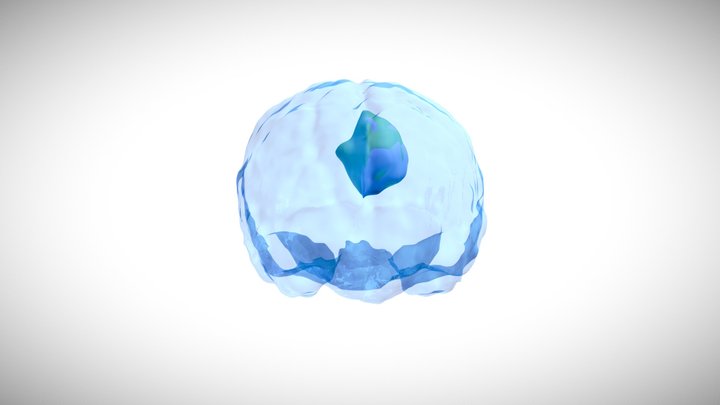Brain Tumor Segmentation 3D Model