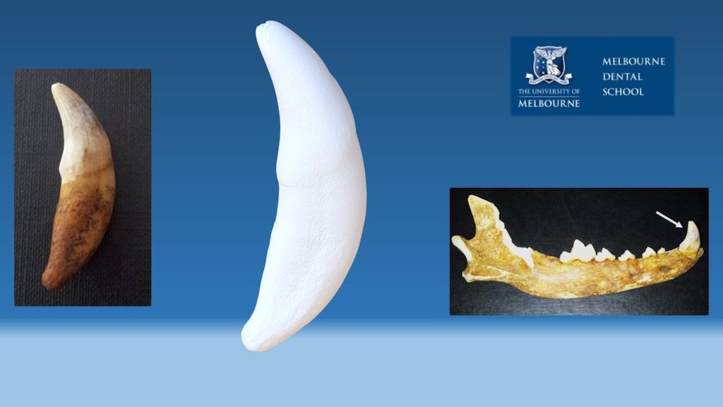 Right lower canine tooth - Download Free 3D model by Melbourne Dental ...