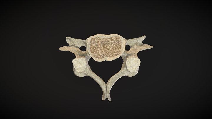 Vertebra Cervical / Cervical Vertebrae 3D Model