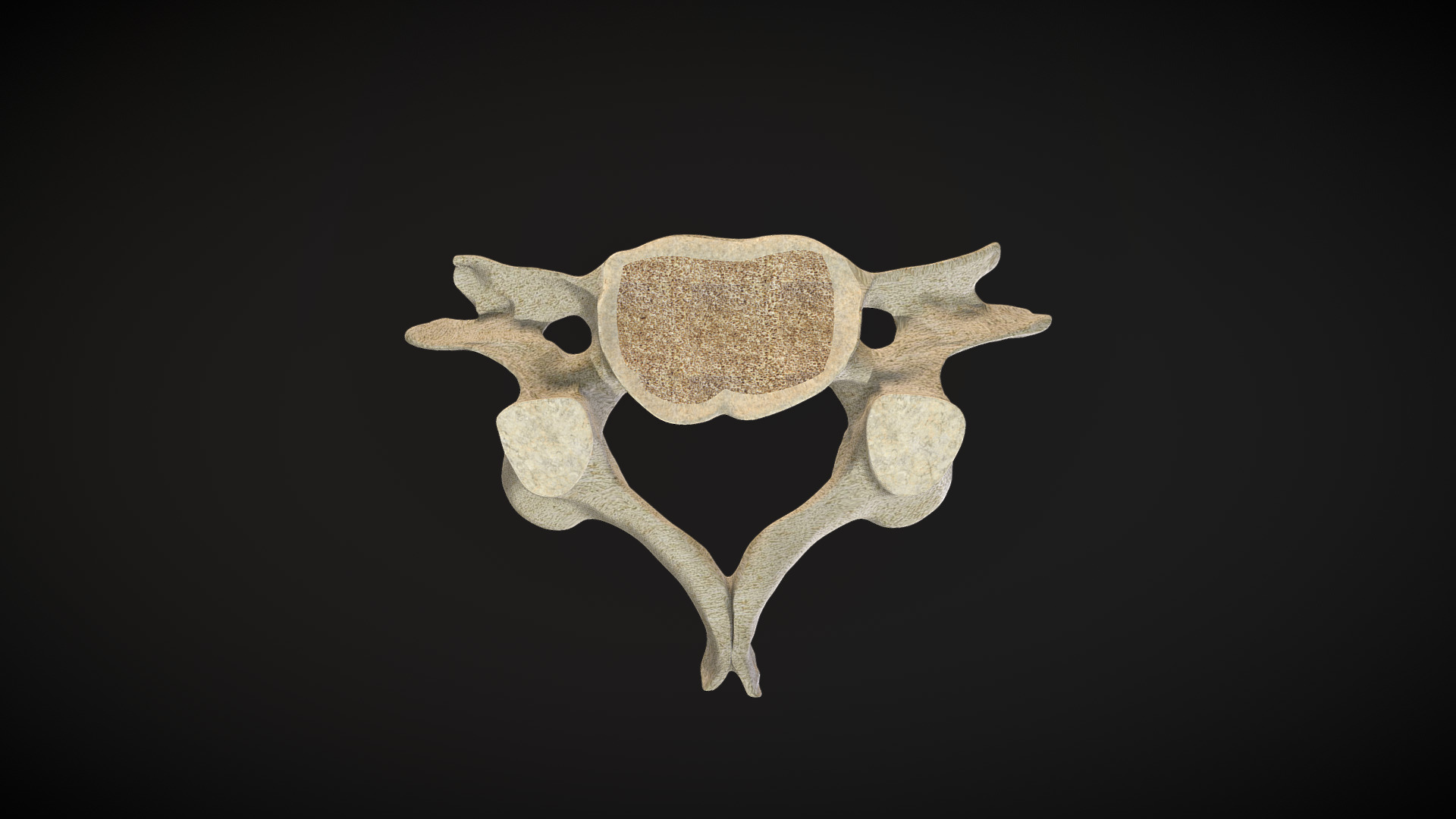3D model Vertebra Cervical / Cervical Vertebrae - This is a 3D model of the Vertebra Cervical / Cervical Vertebrae. The 3D model is about a skull with a black background.