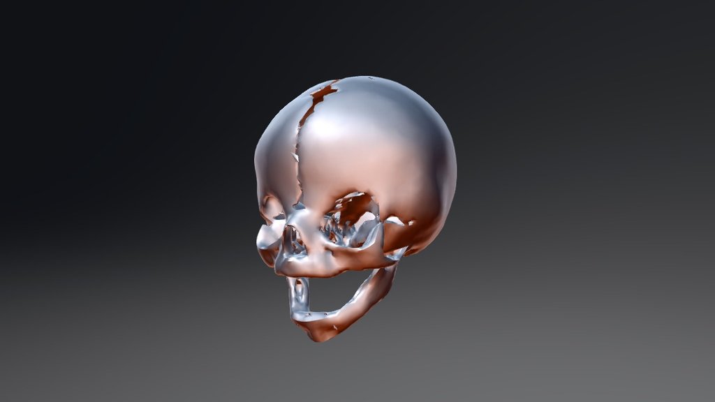 retopoBicor