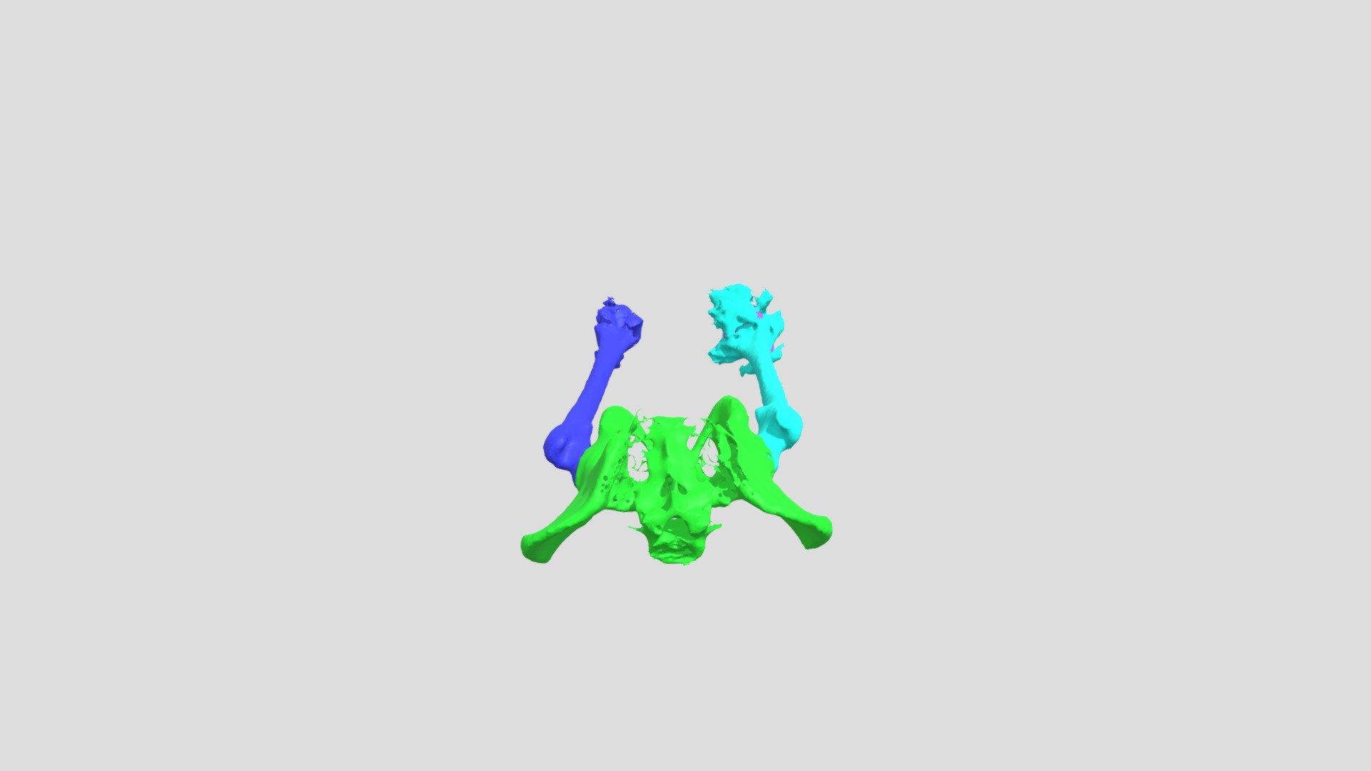 Femur & Pelvis Segmentation