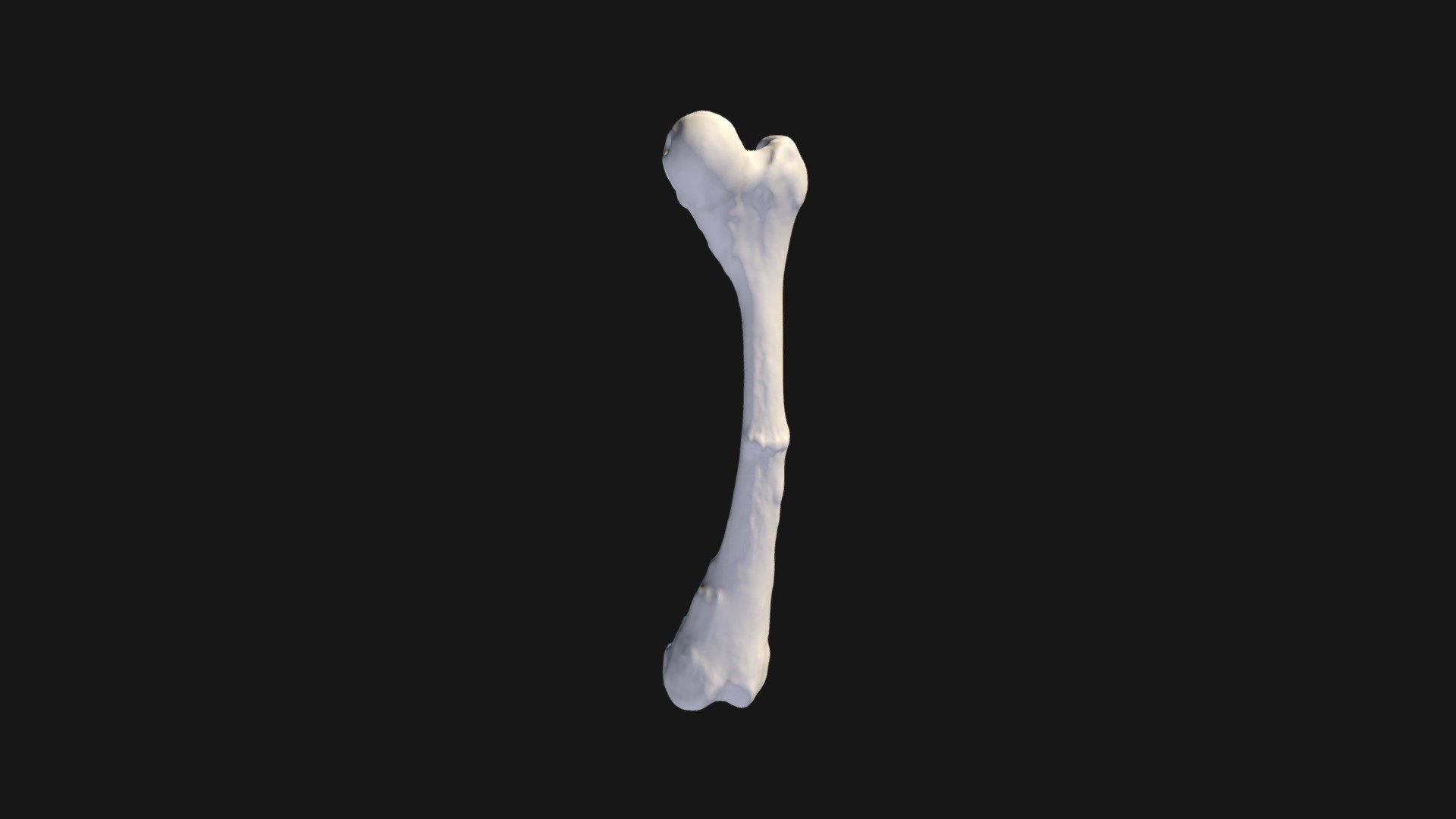 Femur, Left, Pre-surgical - 3D model by APIL (@apil_tgh) [72a1a5c ...