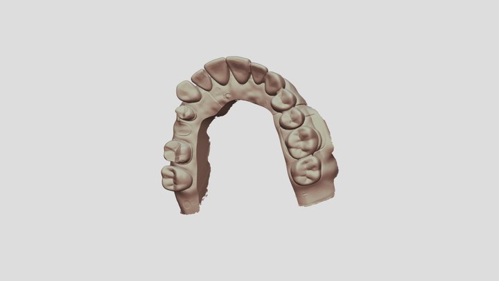 7 Upper Jaw Scan 3D Model