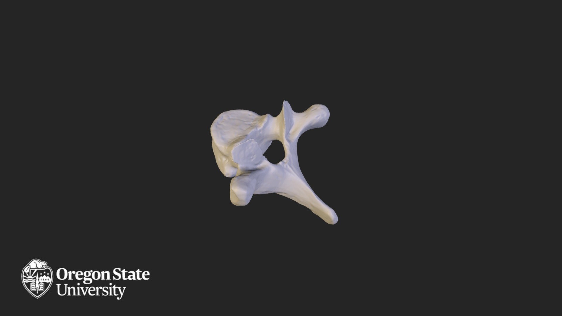 Thoracic vertebra - T2