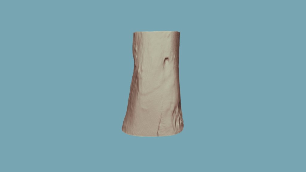 1-4 (Post-burn)