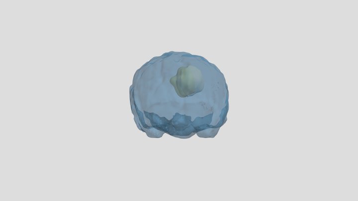 Brain Tumor Segmentation 3D Model