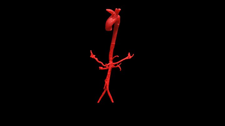 Aorta2 3D Model