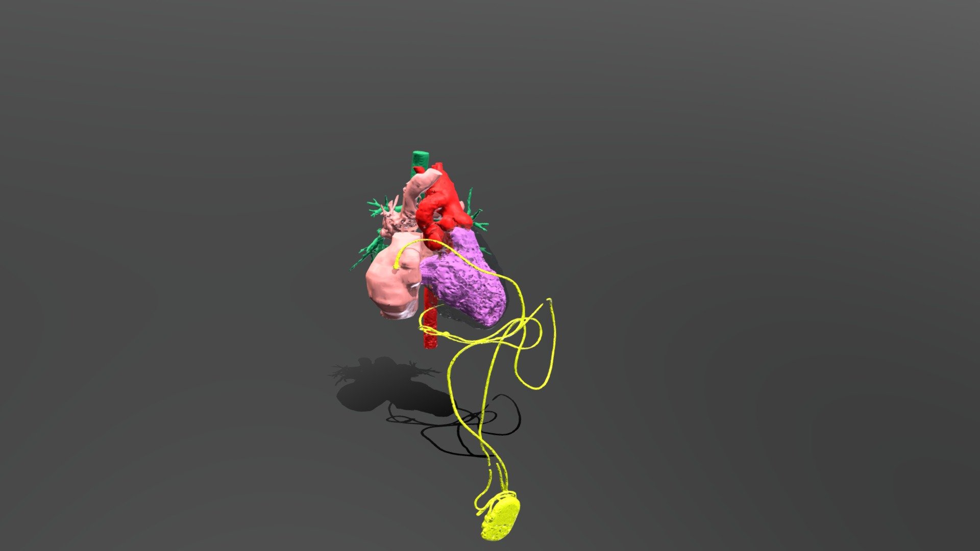 Tin_Ric3D_CardioToracica
