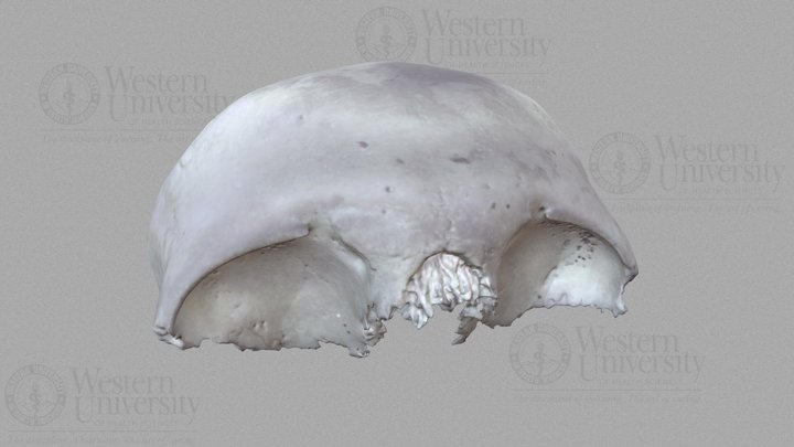 300006 Human Frontal Bone 3D Model