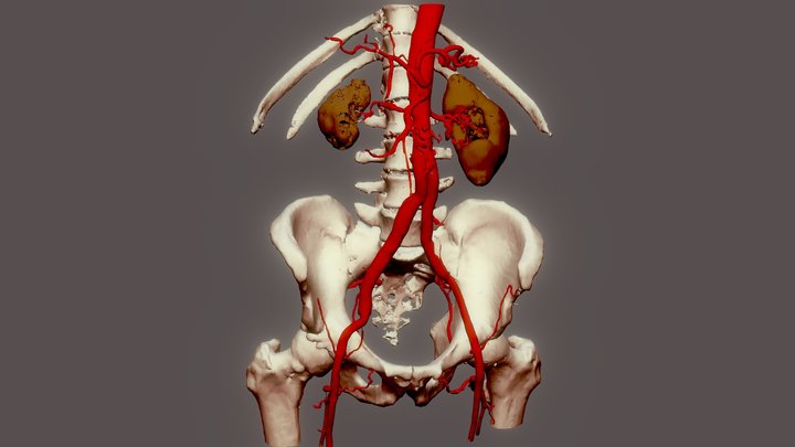 Aorte abdominale 3D Model