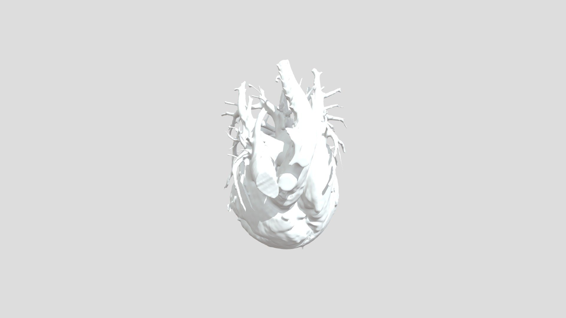 Normal: Heart