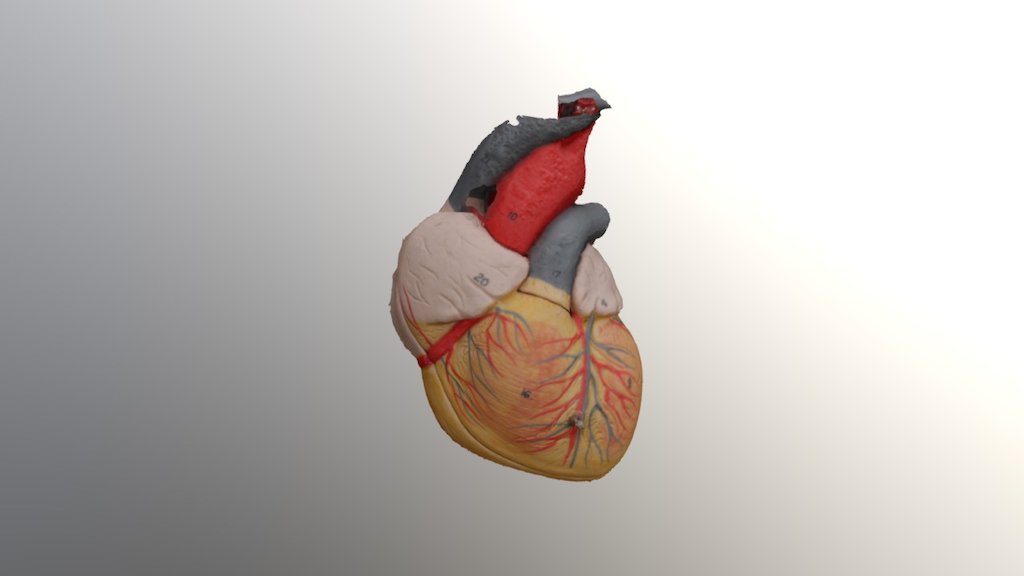Broken Heart