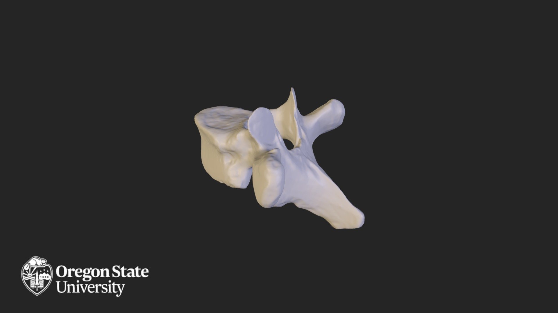 Thoracic vertebra - T4