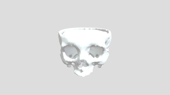 Human Skull with Brain Model (Real CT Scan)