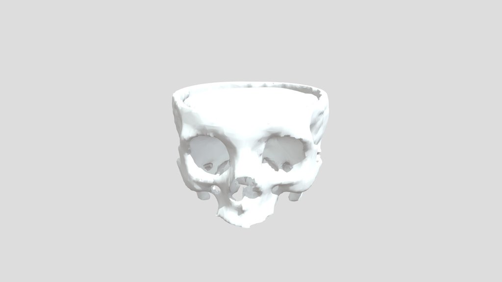 Human Skull with Brain Model (Real CT Scan)