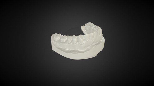 Escaneo 3D: Dentadura 3D Model